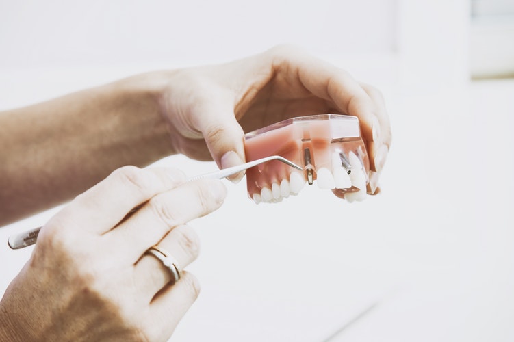 Dental Treatment Consumables