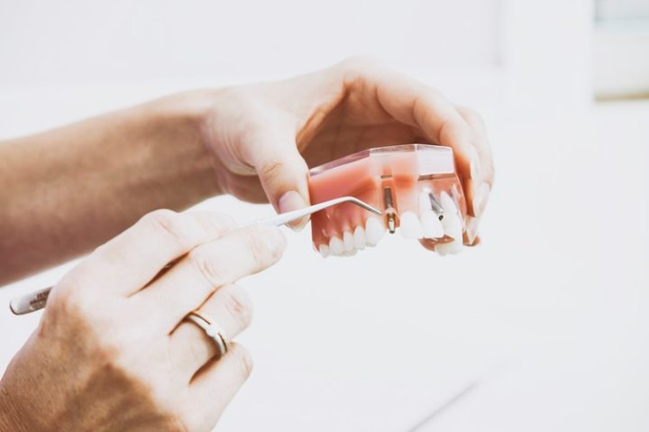 Dental Treatment Consumables