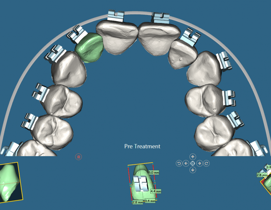Digital Orthodontics