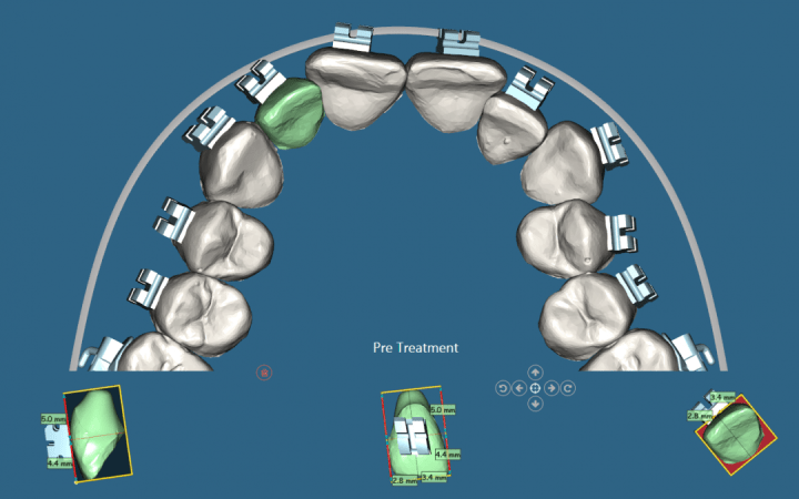 Digital Orthodontics